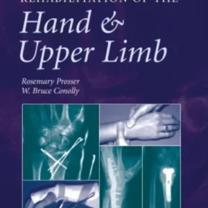 Rehabilitation of the Hand and Upper Limb