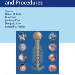 Video Atlas of Endoscopic Spine Surgery and Procedures