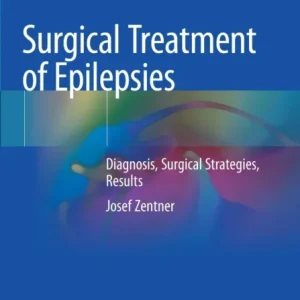 Surgical Treatment of Epilepsies Surgical Treatment of Epilepsies