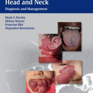 Vascular Lesions of the Head and Neck Vascular Lesions of the Head and Neck
