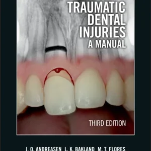 Traumatic Dental Injuries – A Manual 3e